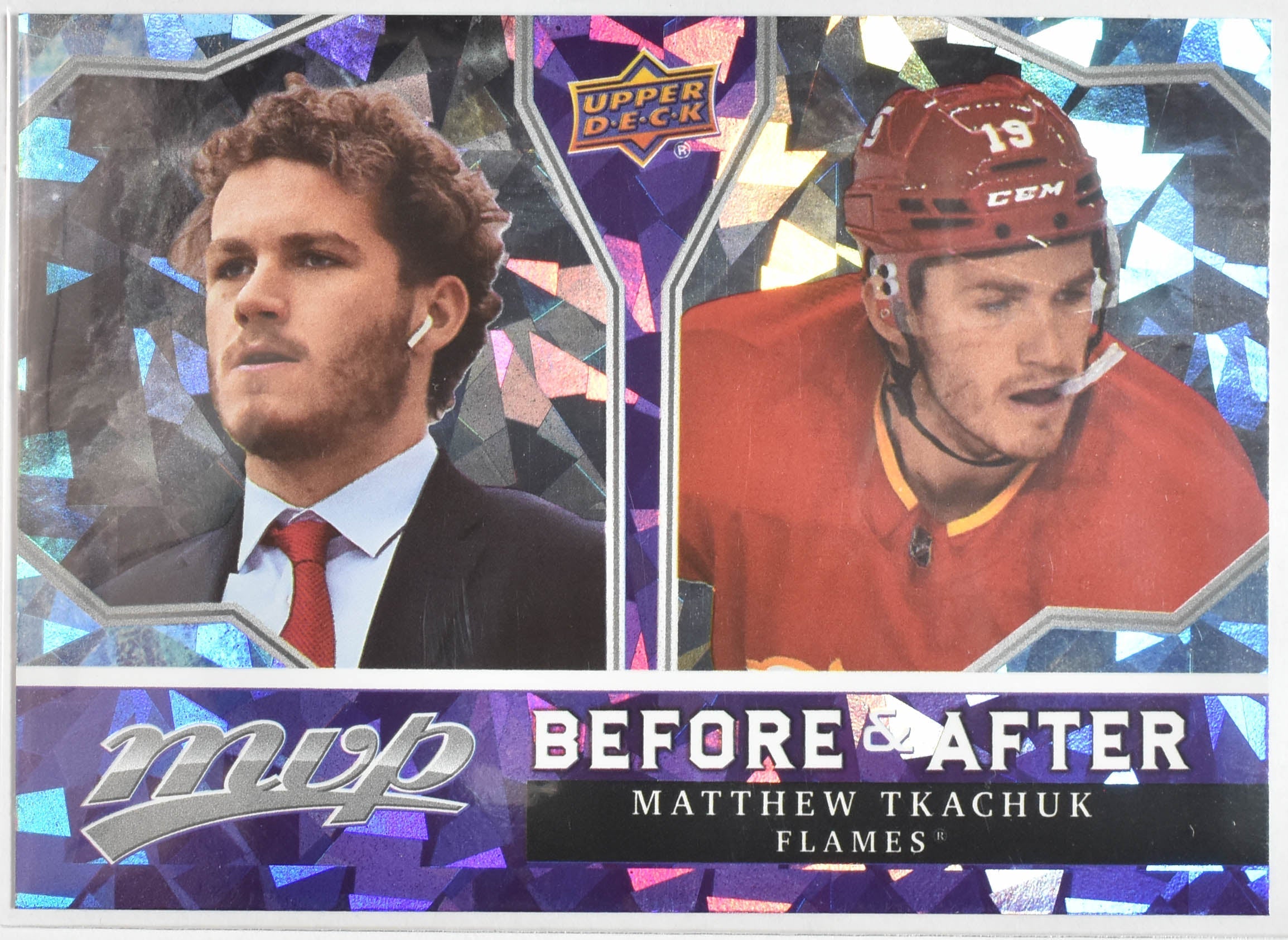 Matthew Tkachuk Before and After BA-16 Flames MVP Upper Deck 2021 Hockey